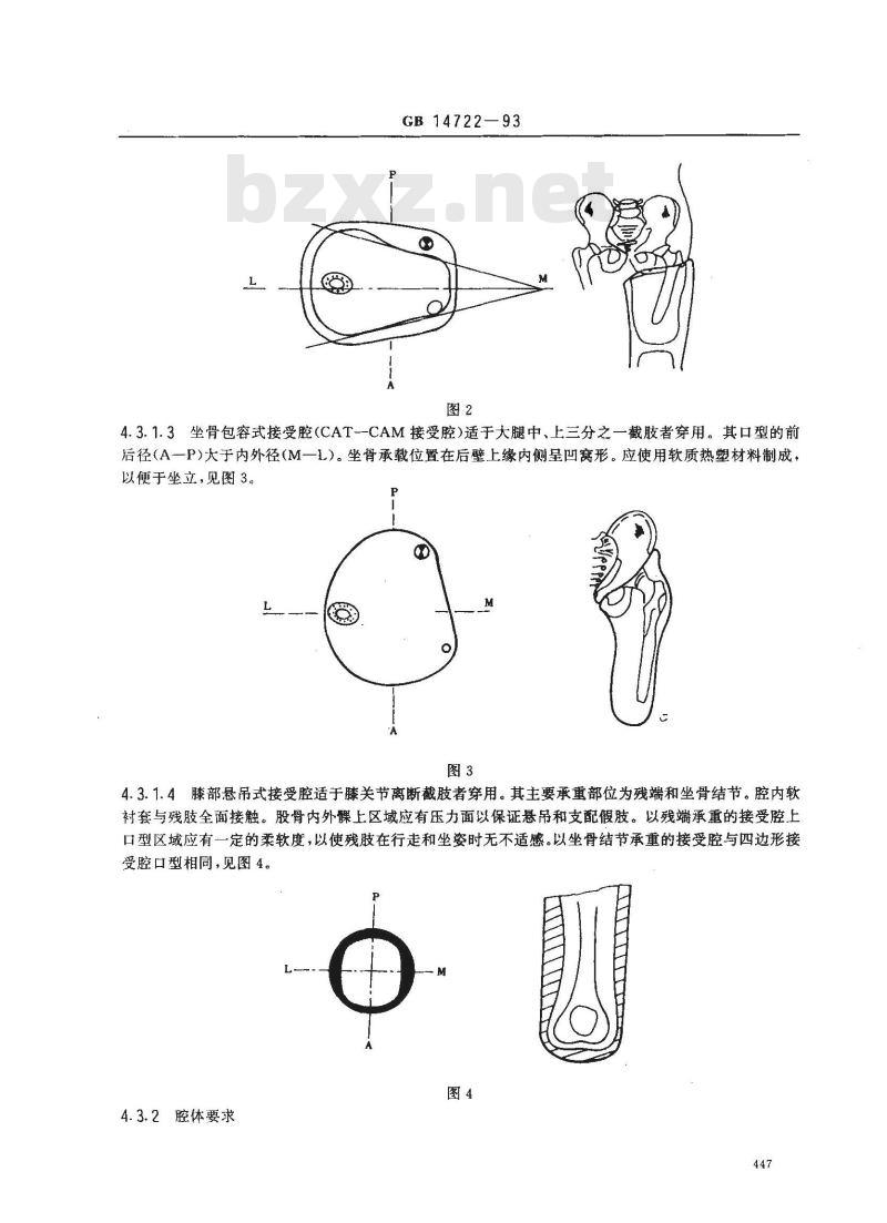 GB 14722-1993 骨骼式大腿假肢